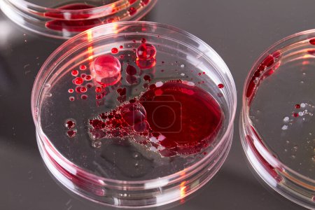 Foto de Cierre las placas de Petri de laboratorio con muestras de sangre. Agar para reservación biológica. - Imagen libre de derechos