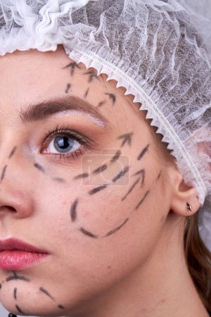 Photo for Vertical shot of womans face with dotted lines. Face lift surgery. - Royalty Free Image