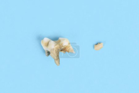 Premolar canine dog tooth with dental calculus and piece of toothing stone broken off