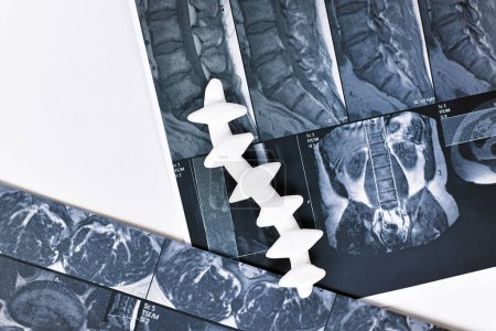 Resonancia magnética de columna vertebral con modelo de columna vertebral 
