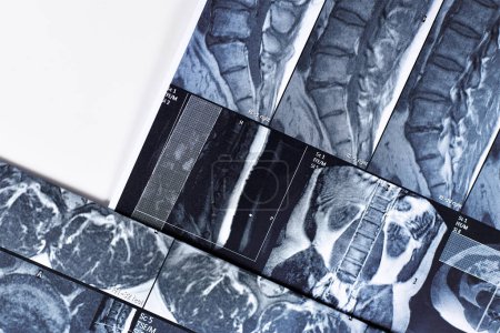 Foto de Copia de resonancia magnética de la columna vertebral humana - Imagen libre de derechos