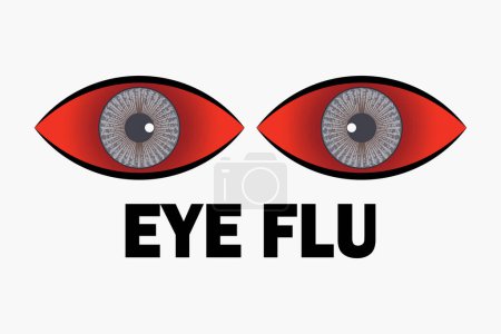 Illustration for Conjunctivitis virus affected red eye,eye flu infection concept with icon design, vector illustration 10 eps graphic. - Royalty Free Image