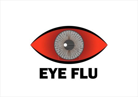 Illustration for Conjunctivitis virus affected red eye,eye flu infection vector illustration on white background. Suitable for website, poster and banner - Royalty Free Image