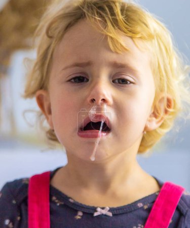Photo for The child has snot, the child is crying. selective focus. Kid. - Royalty Free Image