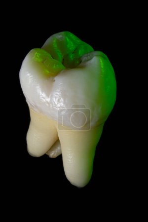 Téléchargez les photos : Dans cette saisissante macro photographie, une dent prémolaire prend le devant de la scène sur fond noir, révélant des détails et des textures complexes. Les contours et les motifs en émail de la dent sont magnifiés, mettant en valeur la beauté de l'anatomie dentaire - en image libre de droit