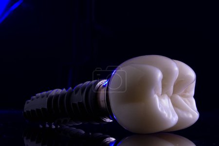 Téléchargez les photos : Implant dentaire avec raccord et couronne en zriconium - en image libre de droit