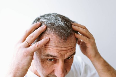 Téléchargez les photos : Middle-aged man demonstrates gray hair, hair loss problem, Close-up of face of brown-eyed man, with facial wrinkles, age spots on skin, shows gray hair on head - en image libre de droit