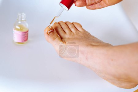 Téléchargez les photos : Gros plan pied féminin nu avec ongle du pied malade, endommagé par un champignon, procédure préventive, huilage peau sèche pied - en image libre de droit