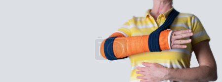 Photo for Woman with broken right arm wearing plaster casts to hold broken bones in place until they heal,hanging her arm in a sling, modern treatments, on a neutral background,copy space, High quality photo - Royalty Free Image