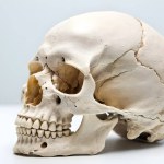 Maxillofacial and skull surgery