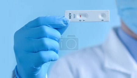 Un médico que usa máscara protectora y guantes muestra una prueba de laboratorio rápida para detectar el virus de la hepatitis C (VHC). La prueba muestra un resultado negativo.