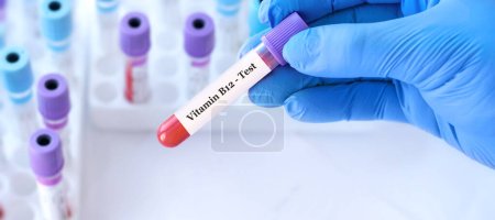 Arzt mit einem Reagenzglas mit Vitamin-B12-Test auf dem Hintergrund medizinischer Reagenzgläser mit Analysen