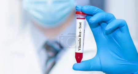 Photo for Doctor holding a test blood sample tube with Vitamin B12 test. - Royalty Free Image
