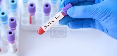 Foto de Médico sosteniendo un tubo de muestra de sangre de prueba con prueba de gripe aviar en el fondo de los tubos de prueba médica con análisis.Banner. - Imagen libre de derechos
