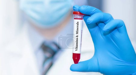 Foto de Médico sosteniendo un tubo de muestra de sangre de prueba con Vitaminas y Minerales.. - Imagen libre de derechos