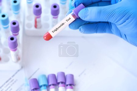 Médico sosteniendo un tubo de muestra de sangre de prueba con prueba de triglicéridos en el fondo de los tubos de prueba médica con análisis