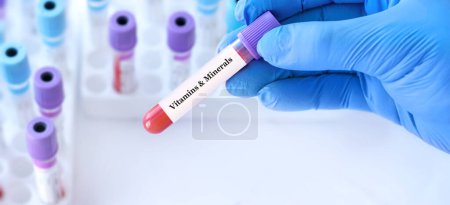 Photo for Doctor holding a test blood sample tube with Vitamins and Minerals test on the background of medical test tubes with analyzes - Royalty Free Image