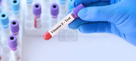 Photo for Doctor holding a test blood sample tube with Vitamin E test on the background of medical test tubes with analyzes.Banner.Copy space for text - Royalty Free Image