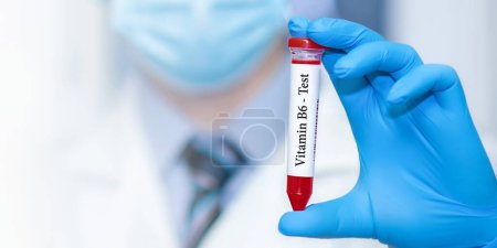 Photo for Doctor holding a test blood sample tube with Vitamin B6 test. - Royalty Free Image