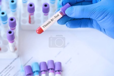 Médico sosteniendo un tubo de muestra de sangre de prueba con la prueba de vitamina B7 en el fondo de los tubos de prueba médica con análisis