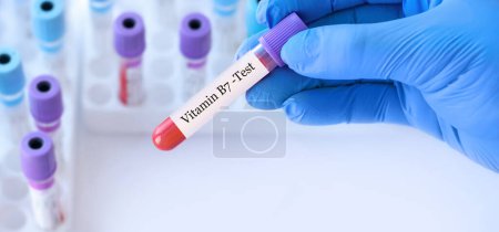 Photo for Doctor holding a test blood sample tube with Vitamin B7 test on the background of medical test tubes with analyzes - Royalty Free Image