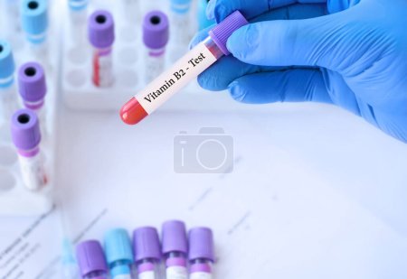 Téléchargez les photos : Médecin tenant un tube à échantillon de sang d'essai avec test de vitamine B2 sur le fond des tubes à essai médicaux avec analyses. - en image libre de droit