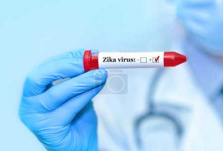 Photo for Doctor holding a test blood sample tube positive with Zika virus test - Royalty Free Image