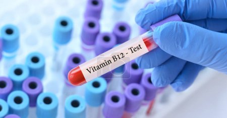 Photo for Doctor holding a test blood sample tube with Vitamin B12 test on the background of medical test tubes with analyzes - Royalty Free Image