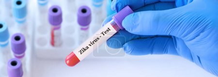 Photo for Doctor holding a test blood sample tube with Zika virus test on the background of medical test tubes with analyzes. Banner. - Royalty Free Image