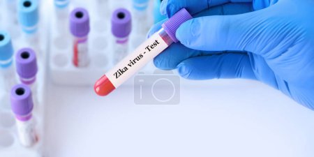 Photo for Doctor holding a test blood sample tube with Zika virus test on the background of medical test tubes with analyzes. Banner. Copy space - Royalty Free Image