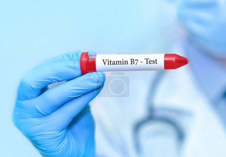 Photo for Doctor holding a test blood sample tube with vitamine B7 test. - Royalty Free Image