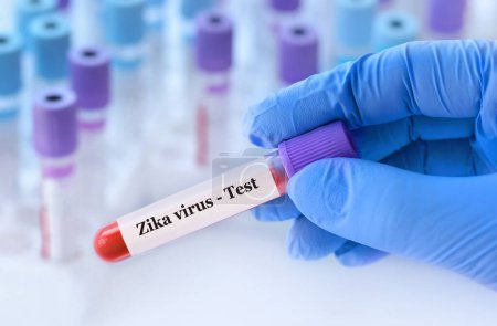 Photo for Doctor holding a test blood sample tube with Zika virus test on the background of medical test tubes with analyzes. - Royalty Free Image