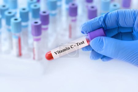 Photo for Doctor holding a test blood sample tube with Vitamin ? test on the background of medical test tubes with analyzes.Banner.Copy space for text - Royalty Free Image