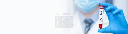Photo for Doctor holding a test blood sample tube with HPV test.Banner. Copy space for text - Royalty Free Image