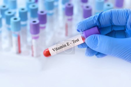 Photo for Doctor holding a test blood sample tube with Vitamin E test on the background of medical test tubes with analyzes.Banner.Copy space for text - Royalty Free Image