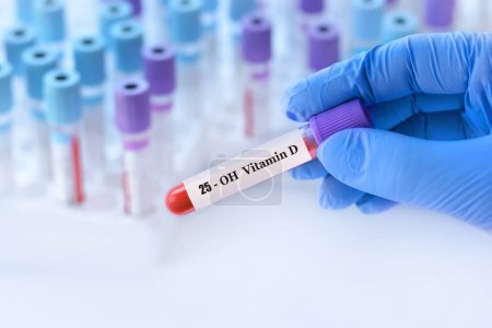 Doctor holding a test blood sample tube with 25 (OH) vitamin D test on the background of medical test tubes with analyzes