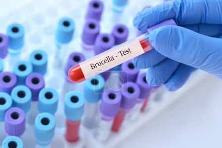 Téléchargez les photos : Médecin tenant une éprouvette de sang avec test Brucella sur le fond des éprouvettes médicales avec analyses - en image libre de droit