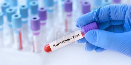 Photo for Doctor holding a test blood sample tube with Norovirus test on the background of medical test tubes with analyzes - Royalty Free Image