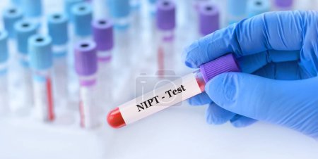 Téléchargez les photos : Médecin tenant une éprouvette de sang avec test NIPT sur le fond des éprouvettes médicales avec analyses - en image libre de droit