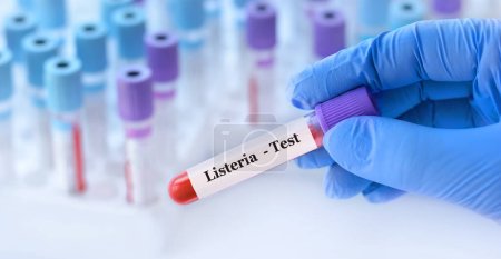 Arzt mit einem Reagenzglas mit Listeria-Bakterien-Test auf dem Hintergrund medizinischer Reagenzgläser mit Analysen