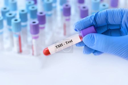 Photo for Doctor holding a test blood sample tube with thyroid stimulating hormone (TSH) test on the background of medical test tubes with analyzes - Royalty Free Image