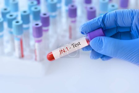 Téléchargez les photos : Médecin tenant une éprouvette sanguine avec test positif au virus JN.1 de la variante CoV-2 du SRAS sur fond de éprouvettes médicales avec analyses. - en image libre de droit