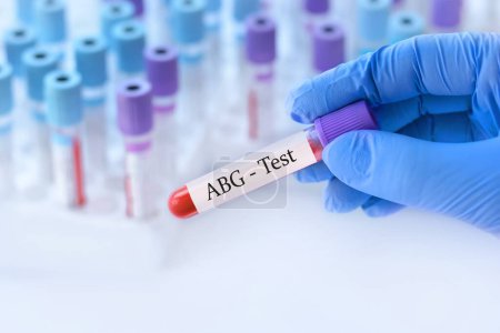 Médico sosteniendo un tubo de muestra de sangre de prueba con prueba ABG en el fondo de tubos de prueba médica con análisis.