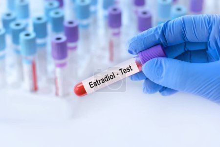 Doctor holding a test blood sample tube with Estradiol test on the background of medical test tubes with analyzes.