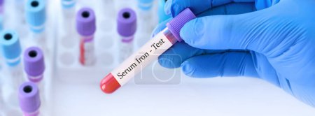 Photo for Doctor holding a test blood sample tube with Serum Iron test on the background of medical test tubes with analyzes. Banner - Royalty Free Image