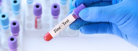 Doctor holding a test blood sample tube with Zinc (Zn) test on the background of medical test tubes with analyzes. Banner