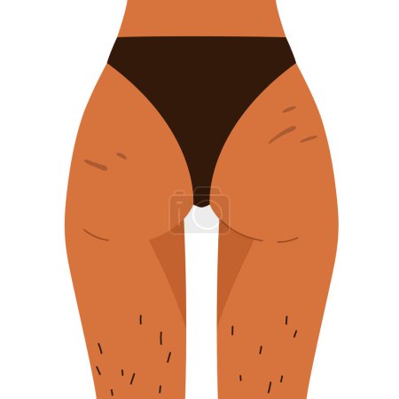 Photo for Woman's buttocks with stretch marks and hairy legs. Body positive, normalize female body hair, body care. Vector illustration in cartoon style. Isolated white background. - Royalty Free Image
