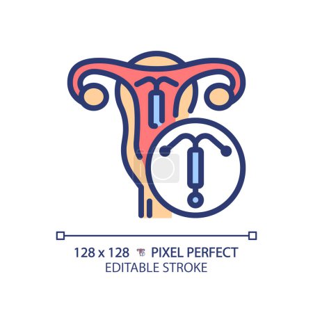 Intrauterine device RGB color icon. Pregnancy prevention, birth control implant. Medical technology, reproductive health. Isolated vector illustration. Simple filled line drawing. Editable stroke