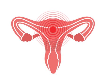 Ilustración de Símbolo de dolor del sistema reproductivo femenino. Icono de dolor del sistema reproductivo. Ilustración vectorial. Dolor en el cuerpo humano punto aislado sobre fondo blanco. - Imagen libre de derechos