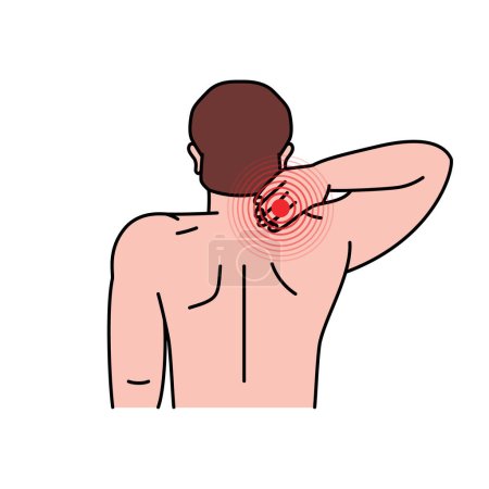 Dolor en la espalda humana. Ache en cabeza, cuello y espalda. Dolor en diferentes partes del cuerpo del hombre. Ilustración vectorial. Problema de salud del dolor muscular y problemas de columna.